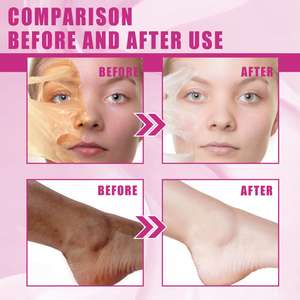 Liquide de soin de la peau jaune extra fort oem Femme <span class=keywords><strong>O</strong></span> Service de marque privée Soins des pieds et des mains Huile de gommage pour le nez - Product Image 6