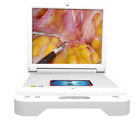 Système de caméra endoscopique médicale chirurgicale Portable pour laparoscopie laparoscopique ent arthroscopie arthroscopique
