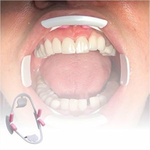 Écarteur de joue dentaire 3D élastique pratique, écarteur buccal intra-oral, ouvre-bouche pour accessoires dentaires, 2 pièces (S) - Product Image 5