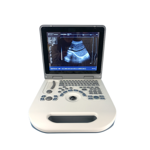 Penjualan terlaris SUN-806G <span class=keywords><strong>ultrasound</strong></span> medis BW <span class=keywords><strong>Ultrasound</strong></span> 2D ginekologi notebook kehamilan mesin <span class=keywords><strong>ultrasound</strong></span> USG - Product Image 1
