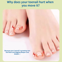 Autocollants pour ongles en forme de U, élastiques, beiges, pour les ongles incarnés |   Patchs orthopédiques ajustables sans colle pour manucure