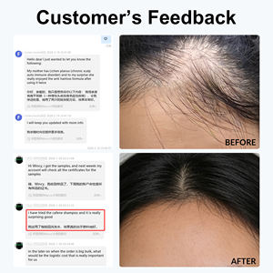 <span class=keywords><strong>Champú</strong></span> y Acondicionador para Cabello Fino y Quebradizo, Fórmula con Fito-Cafeína, Promueve el Crecimiento Natural para el Cabello Fino de Mujer - Product Image 6