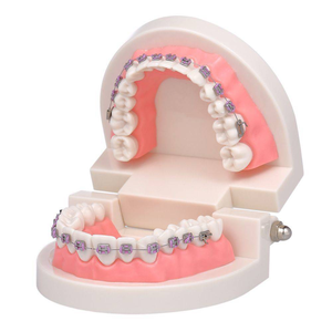 Modelo Dental Portátil de PVC para Enseñanza de Ortodoncia con Aparatos Ortodóncicos - Product Image 4