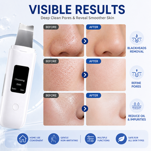 Ultrasonic Skin Scrubber Facial Cleansing <b>Blackhead</b> Pore <b>Cleaner</b> Handheld Face Nose Cleansing Ultrasonic Facial Skin Scrubber - Product Image 3