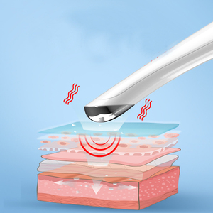 Regalo barato para mujer, portátil, alimentado por batería, calefacción eléctrica, labio, cuidado de los ojos, pluma de masaje, varita, dispositivo de herramienta de belleza para ojos - Product Image 5