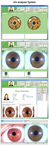 Analyseur de peau numérique portable, appareil d'analyse de la peau du visage 3D pour le test cutané, détection de l'iris et analyse du cuir chevelu - Product Image 3