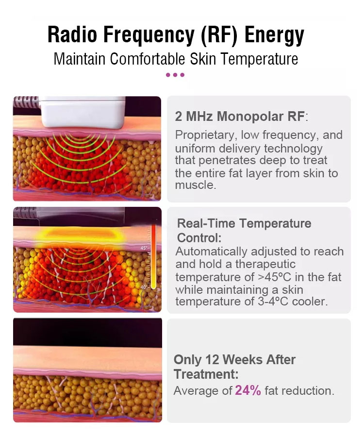 professional 10 handles cellulite body contouring 3d rf slimming trusculpt id and flex machine / trusculpt rf device