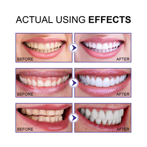 Limpieza Profunda de Dientes, Eliminación de Manchas de Café y Té, Blanqueamiento y Aclarado en 3 Días Polvo Blanqueador Dental 80ml para Uso Doméstico Adultos - Product Image 6