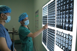 Ct160 16MP độ sáng cao có thể điều chỉnh y tế X-Ray phim Scanner và người xem CT Scanner y tế LED phim tiêu cực - Product Image 3