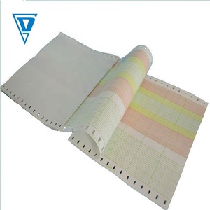 Papel para Monitor Fetal <span class=keywords><strong>CTG</strong></span>, Ultrasonido y ECG para Uso Médico - Product Image 4