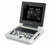 Machine d'ultrasons portable à ultrasons de 12.1 pouces, appareil médical, bon marché, ordinateur portable, PW