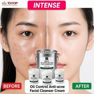 Suero Despigmentante de Piña, Suero Facial Iluminador con Alfa Arbutina <span class=keywords><strong>y</strong></span> Niacinamida, Base en Crema Sin Perfume - Product Image 1