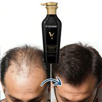 Natürliches Kräuter-Shampoo und Conditioner Set gegen Haarausfall für Gesunde Kopfhaut, Haarwuchs und Verdichtung