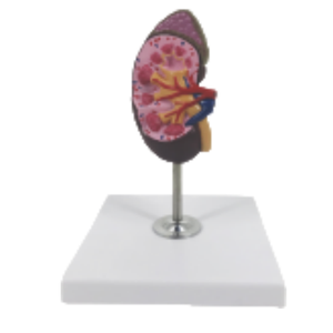 Modelo de anatomía renal ADA Medical Science con modelo de glándula suprarrenal U022C/U022D, origen Shanghái, para entrenamiento y demostración de enfermedades - Product Image 4
