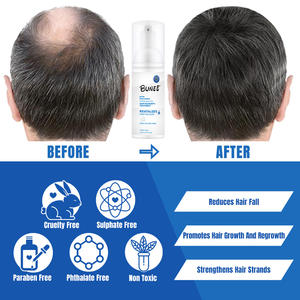 Nouvelle conception 60ml mousse de croissance des cheveux pour hommes cuir chevelu romarin épaississement traitement des cheveux argan Rogain biotine mousse de perte de cheveux - Product Image 3