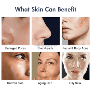 Dispositivo <span class=keywords><strong>2</strong></span> en 1 de Hidrofacial con Vórtice Rotatorio de 360° y Pistola de Mesoterapia de Alta Presión para Limpieza Profunda de la Piel, Infusión de Suero Hidra Peeling - Product Image 5