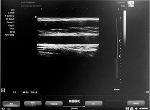SS-9B máy siêu âm cho thú Y/con người sonostar xách tay máy tính xách tay máy siêu âm - Product Image 5