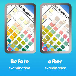 Merydi 10'u 1 Arada İdrar <span class=keywords><strong>Test</strong></span> Şeritleri Tanı Kiti (Kan Özgül Ağırlığı Lökositleri) Sınıf II CE Sertifikalı Evde Kullanım %96 Doğruluk - Product Image 5