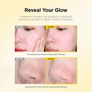 Crème Nettoyante Douce Anti-Points Noirs Personnalisée Sous Marque Privée, Démaquillant, Baume Nettoyant Pores au PHA - Product Image 3