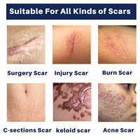 Améliore l'apparence des cicatrices d'acné Silicone Scar Gel 30g
