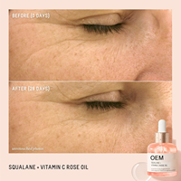 Sérum Visage OEM au Squalane, Vitamine C, Huile de Rose, Niacinamide, Zinc PCA, Raffermissant, Anti-Âge, Éclaircissant et Hydratant, 30ml pour la Peau