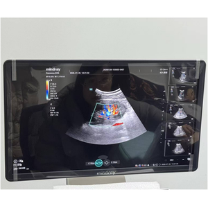 Ecógrafo Doppler Color Mindray Consona N5 para Diagnóstico, Máquina de Ultrasonido para Cardiología, Abdomen y Vascular - Product Image 5