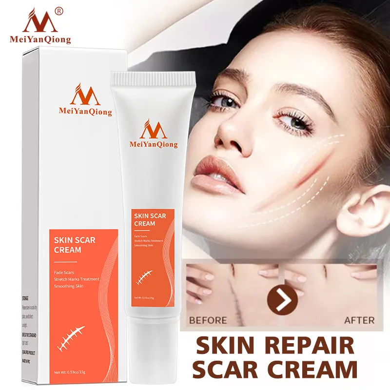 MeiYanQiong Hautre paratur Narben creme Akne-Behandlung Anti-Narben-Dehnung streifen White ning Cream MYQ026