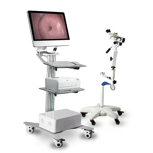 Optical Digital Colposcope for Obstetrics & Gynecology High-Tech Equipment