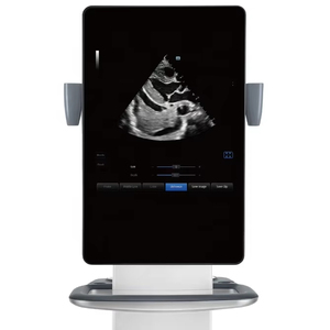 Système d'échographie professionnel Mindray, Mindray TE9, échographie Doppler couleur portable, équipement médical vétérinaire - Product Image 1