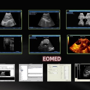 Échographe vétérinaire portable à écran tactile noir et blanc, transducteurs sonars, modèle BW08vet, le plus vendu à prix abordable - Product Image 6