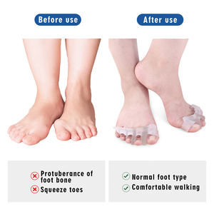 थोक पांच पैर की अंगुली स्ट्रेचर विभाजक फुट दर्द राहत आर्थोपेडिक के लिए सिलिकॉन <span class=keywords><strong>Bunion</strong></span> पढ़नेवाला जेल पैर की अंगुली विभाजक - Product Image 4