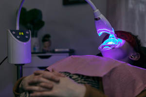 Gel blanqueador dental para uso profesional, suministro de fábrica de 2,5 ml/5ml, 35% HP, peróxido de hidrógeno 22% - Product Image 5