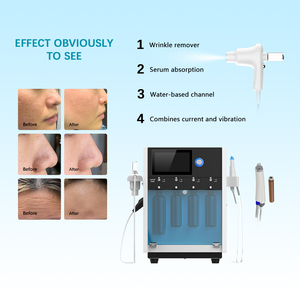 <span class=keywords><strong>Beco</strong></span> 2 trong 1 Aqwa Lột Loại Bỏ Mụn Đầu Đen Làm Sạch Da Mặt Dermo Electro poration Máy - Product Image 4