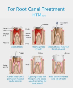 HTM Dental Equipment Manufactur LOGO Label Dental Instrumental NITI Products for Machine Rotatory <strong>Files</strong> for Root Canal Treatment - Product Image 4