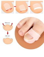 Protector de Dedos de Gel de Sílice YNGB, Aclara el Tono de Piel, Protección Efectiva para Uñas de Pies y Manos, Previene la Decoloración de los Dedos Largos