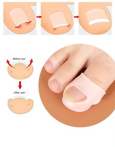 YNBG Gel de silice protecteur doux pour les orteils, éclaircissant le teint, protection efficace des ongles des pieds et des doigts, prévient l'épaississement des cuticules des doigts longs - Product Image 4