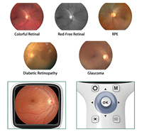 Cámara de Fondo de Ojo Portátil HFC-1, Instrumento Oftálmico Digital de Alta Definición para Uso Veterinario y Humano