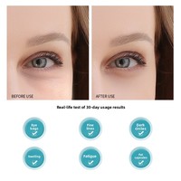 Masseur oculaire électrique portable étanche pour le soin des yeux, modèle ZM5077, pour usage domestique avec effet raffermissant sur la zone des yeux