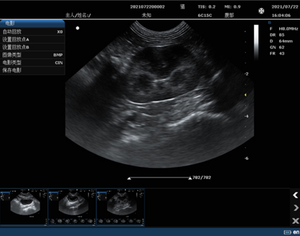Alat Diagnostik Gigi dan Hewan Peliharaan Portabel Multi-Fungsi B-<span class=keywords><strong>Scan</strong></span> Color Doppler <span class=keywords><strong>Ultrasound</strong></span> - Product Image 5