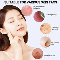 Stylo à plasma oxygène portatif pour le traitement de l'acné du visage, nettoyage, lifting cutané, stylo à plasma froid à l'ozone