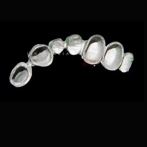 Tecnologia di stampa Laser 3D per cliniche dentali personalizzate corone e ponti in Cina laboratorio dentale - Product Image 3