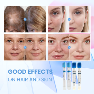 OEM 10ml 12ml <span class=keywords><strong>15ml</strong></span> saç büyüme santrifüj trombosit zengin plazma <span class=keywords><strong>PRP</strong></span> tüp teşvik - Product Image 4