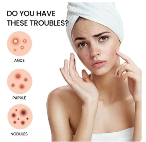 Parche reparador para acné, cuidado facial de la piel, manchas que se desvanecen, marcas de espinillas, cubierta cerrada para manchas de acné, parche de reparación de espinillas - Product Image 6