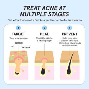 Suero Facial de Ácido Salicílico de Marca Blanca para Limpieza Profunda de Poros, Reparación de la <span class=keywords><strong>Piel</strong></span> y Tratamiento Equilibrante para Todo Tipo de <span class=keywords><strong>Piel</strong></span> - Product Image 4