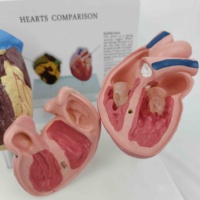 Modèle anatomique comparatif du cœur d'un fumeur KyrenMed, modèle pathologique du cœur, comparaison du cœur sain et du cœur fumeur