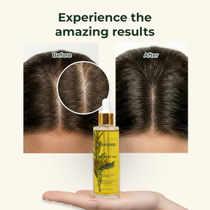 Huile de romarin très vendue pour la croissance des cheveux, sérum de croissance capillaire et <span class=keywords><strong>traitement</strong></span> fortifiant pour cheveux en marque blanche, vente en gros - Product Image 3