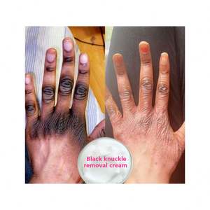 Sérum éclaircissant rapide pour les articulations foncées, correcteurs de pigmentation pour la <span class=keywords><strong>peau</strong></span> noire, mains, genoux, coudes, crème éliminatrice de taches intenses - Product Image 1