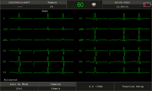Medsinglong Medical tragbarer 12-Lead-EKG-Monitor EKG-Elektorkardiogramm 12-Kanal-EKG-EKG-Gerät Preis - Product Image 5