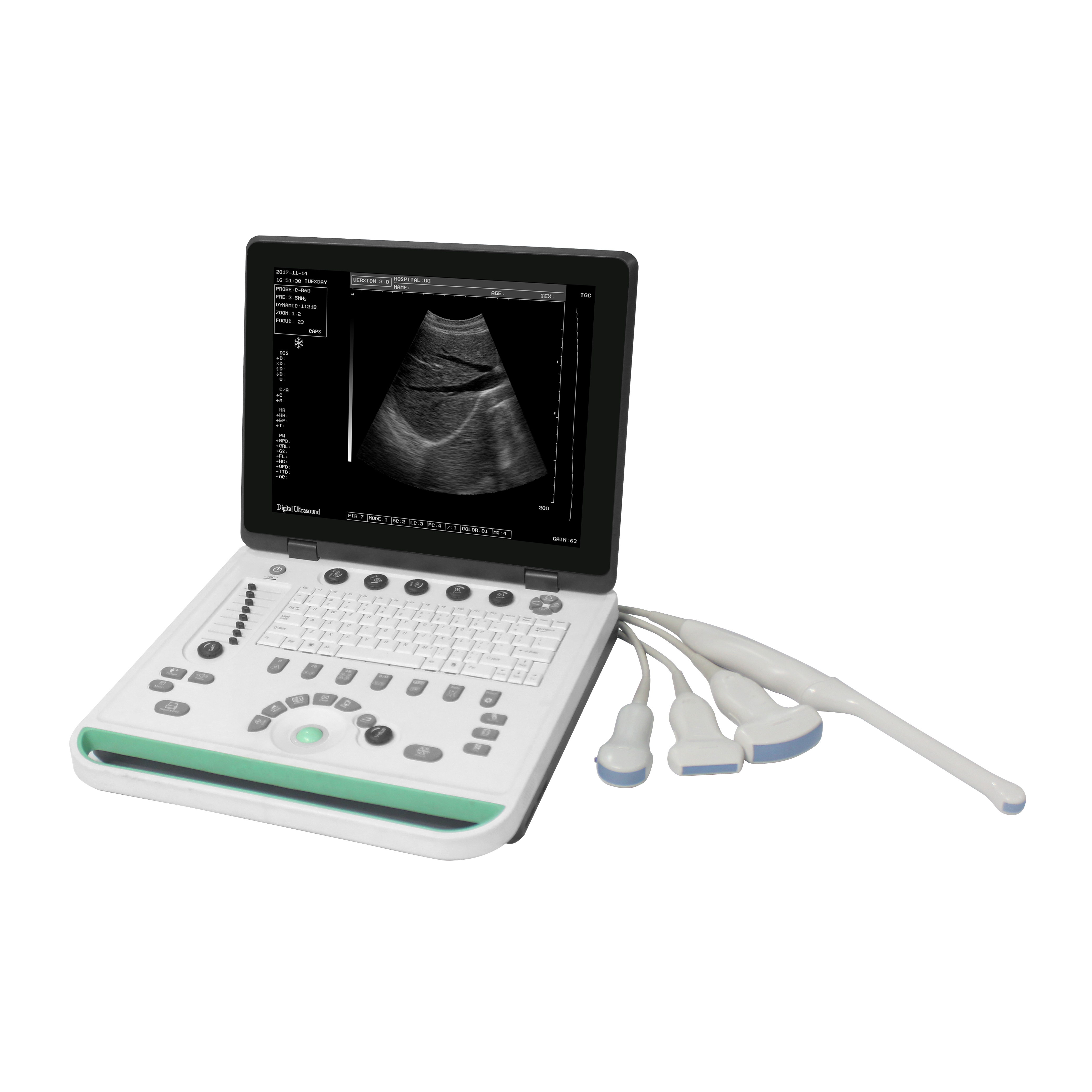 maMN-Ultra1 Basic B Ultrasound Full Digital Ultrasound  Instrument With  Pseudo-color Function