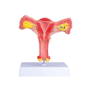 แบบจำลองมดลูกและรังไข่ทั้งสองด้าน แบบจำลองมดลูกหญิง สำหรับสื่อการสอน การเรียนรู้วิทยาศาสตร์การแพทย์ กายวิภาคศาสตร์ แบบจำลองมดลูก - Product Image 1